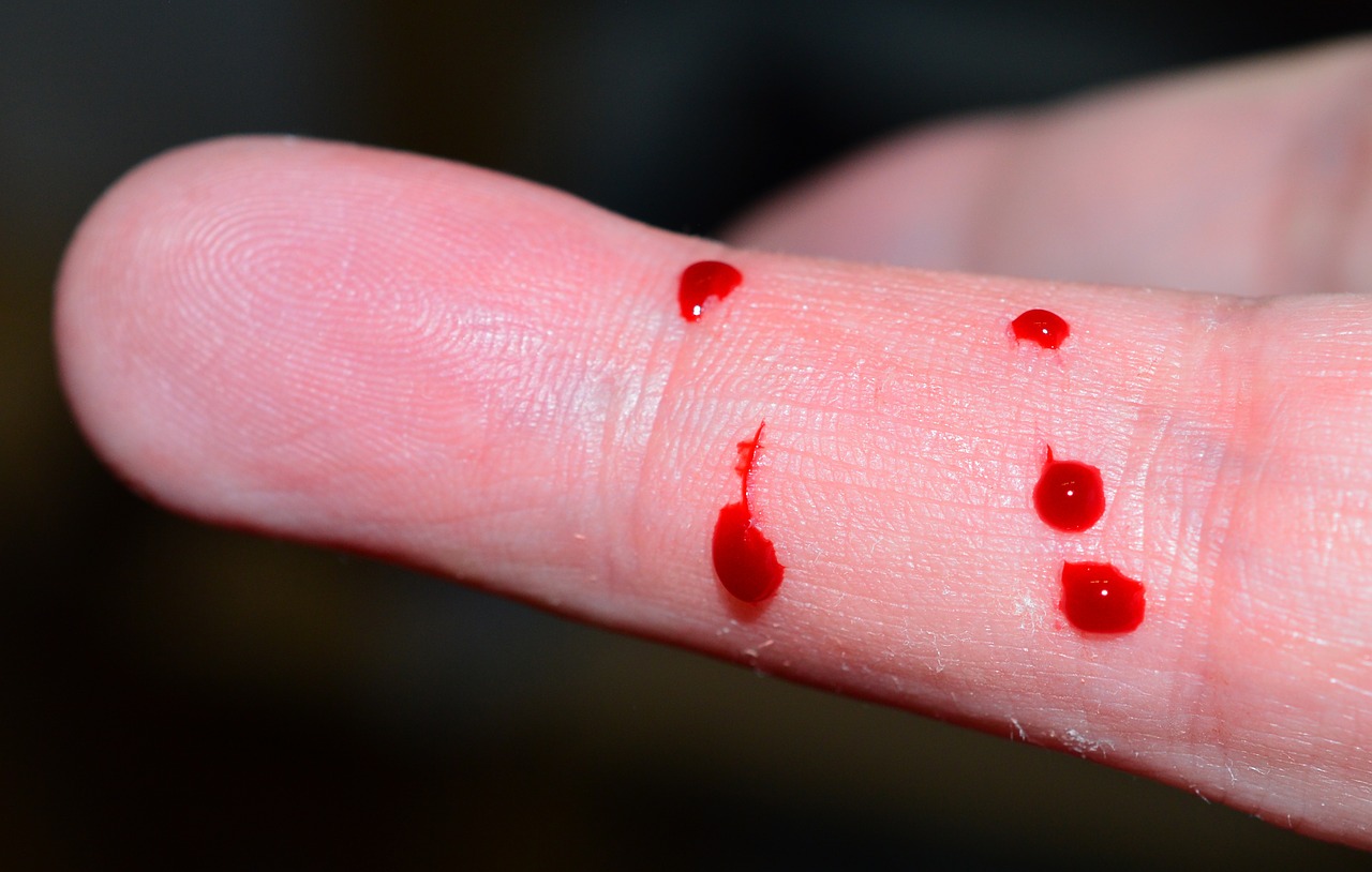Pierwsza pomoc w krwawieniu z palca